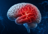 Semne care pot apărea cu săptămâni înaintea unui AVC. Ce spun specialiștii despre semnalele de alarmă Semne de avertizare care pot apărea înaintea unui accident vascular cerebral